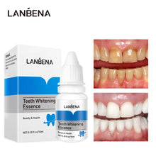Charger l&#39;image dans la galerie, Lanbena pour blanchir les dents, produit de santé buccale