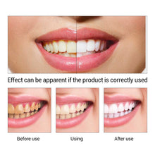 Charger l&#39;image dans la galerie, Lanbena pour blanchir les dents, produit de santé buccale