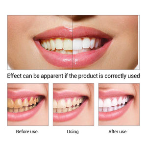 Lanbena pour blanchir les dents, produit de santé buccale